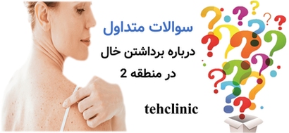 سوالات متداول درباره برداشتن خال در منطقه ۲