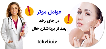 عوامل موثر در جای زخم بعد از برداشتن خال