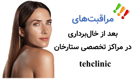 مراقبت‌های بعد از خال‌برداری در مراکز تخصصی ستارخان