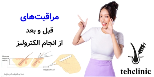 مراقبت‌های قبل و بعد از انجام الکترولیز