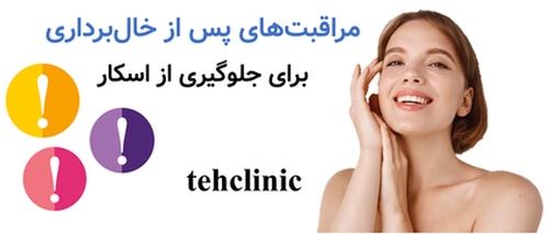 مراقبت‌های پس از خال‌برداری برای جلوگیری از اسکار