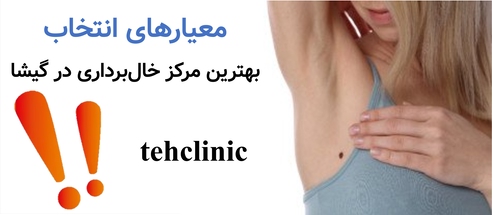 معیارهای انتخاب بهترین مرکز خال‌برداری در گیشا