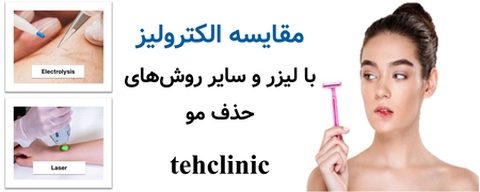 مقایسه الکترولیز با لیزر و سایر روش‌های حذف مو