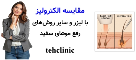 مقایسه الکترولیز با لیزر و سایر روش‌های رفع موهای سفید