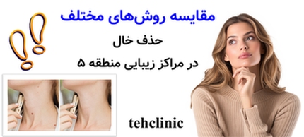 مقایسه روش‌های مختلف حذف خال در مراکز زیبایی منطقه ۵