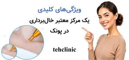 ویژگی‌های کلیدی یک مرکز معتبر خال‌برداری در پونک