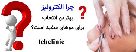 چرا الکترولیز بهترین انتخاب برای موهای سفید است؟