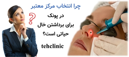 چرا انتخاب مرکز معتبر در پونک برای برداشتن خال حیاتی است؟