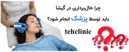 چرا خال‌برداری در گیشا باید توسط پزشک انجام شود؟