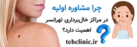 چرا مشاوره اولیه در مراکز خال‌برداری تهرانسر اهمیت دارد؟