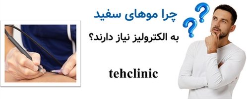 چرا موهای سفید به الکترولیز نیاز دارند؟