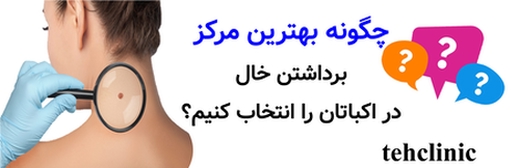 چگونه بهترین مرکز برداشتن خال در اکباتان را انتخاب کنیم؟