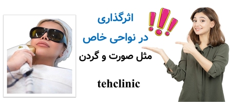 اثرگذاری در نواحی خاص مثل صورت و گردن