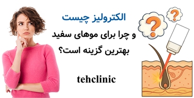 الکترولیز چیست و چرا برای موهای سفید بهترین گزینه است؟