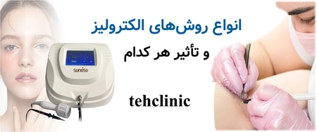 انواع روش‌های الکترولیز و تأثیر هر کدام