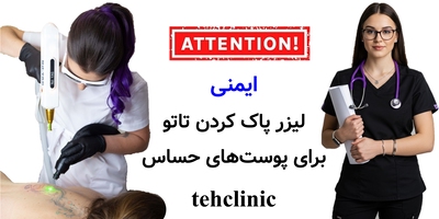 ایمنی لیزر پاک کردن تاتو برای پوست‌های حساس
