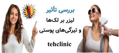 بررسی تأثیر لیزر بر لک‌ها و تیرگی‌های پوستی
