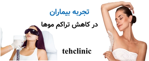 تجربه بیماران در کاهش تراکم موها