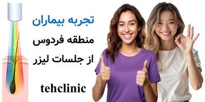 تجربه بیماران منطقه فردوس از جلسات لیزر