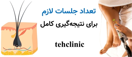 تعداد جلسات لازم برای نتیجه‌گیری کامل