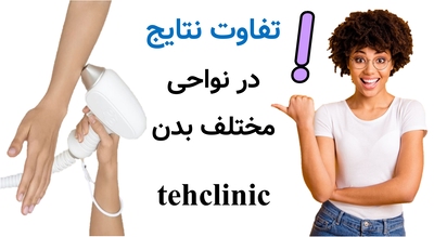 تفاوت نتایج در نواحی مختلف بدن