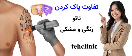 تفاوت پاک کردن تاتو رنگی و مشکی