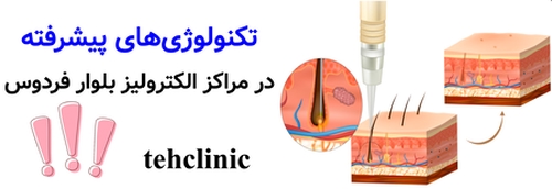 تکنولوژی‌های مدرن در مراکز الکترولیز فردوس