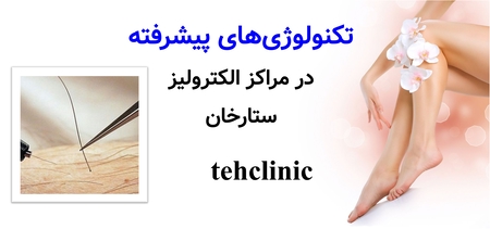 تکنولوژی‌های پیشرفته در مراکز الکترولیز ستارخان