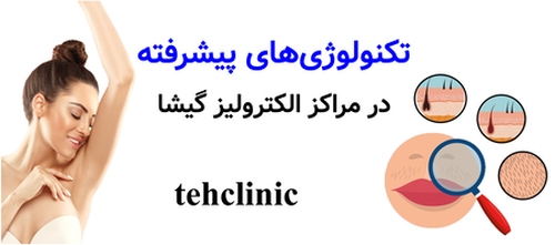 تکنولوژی‌های پیشرفته در مراکز الکترولیز گیشا