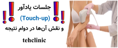 جلسات یادآور (Touch-up) و نقش آن‌ها در دوام نتیجه