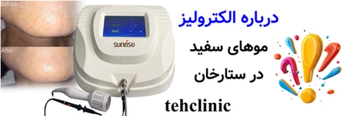 درباره الکترولیز موهای سفید در ستارخان