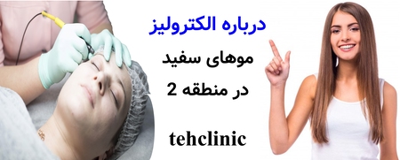 درباره الکترولیز موهای سفید در منطقه ۲