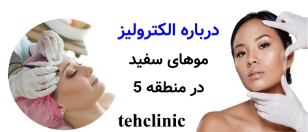 درباره الکترولیز موهای سفید در منطقه ۵