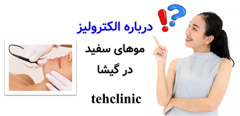درباره الکترولیز موهای سفید در گیشا