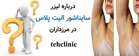 درباره لیزر سایناشور الیت پلاس در مرزداران