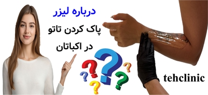 درباره لیزر پاک کردن تاتو در بلوار فردوس