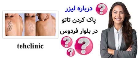 درباره لیزر پاک کردن تاتو در بلوار فردوس