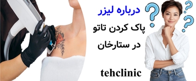 درباره لیزر پاک کردن تاتو در ستارخان
