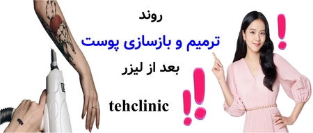 روند ترمیم و بازسازی پوست بعد از لیزر