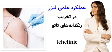 عملکرد علمی لیزر در تخریب رنگدانه‌های تاتو