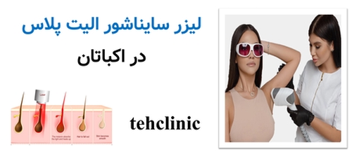 لیزر سایناشور الیت پلاس اکباتان