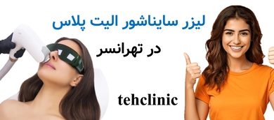لیزر سایناشور الیت پلاس تهرانسر