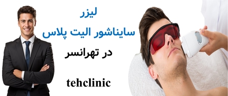 لیزر سایناشور الیت پلاس در تهرانسر