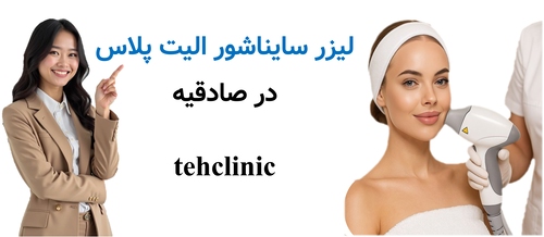 لیزر سایناشور الیت پلاس در صادقیه