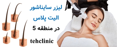 لیزر سایناشور الیت پلاس در منطقه 5