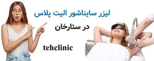 لیزر سایناشور الیت پلاس ستارخان