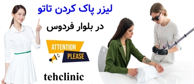 لیزر پاک کردن تاتو در بلوار فردوس