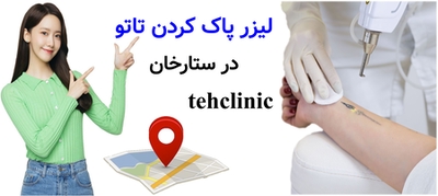 لیزر پاک کردن تاتو در ستارخان