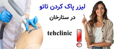 لیزر پاک کردن تاتو ستارخان