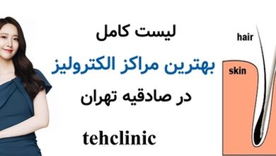 لیست کامل بهترین مراکز الکترولیز در صادقیه